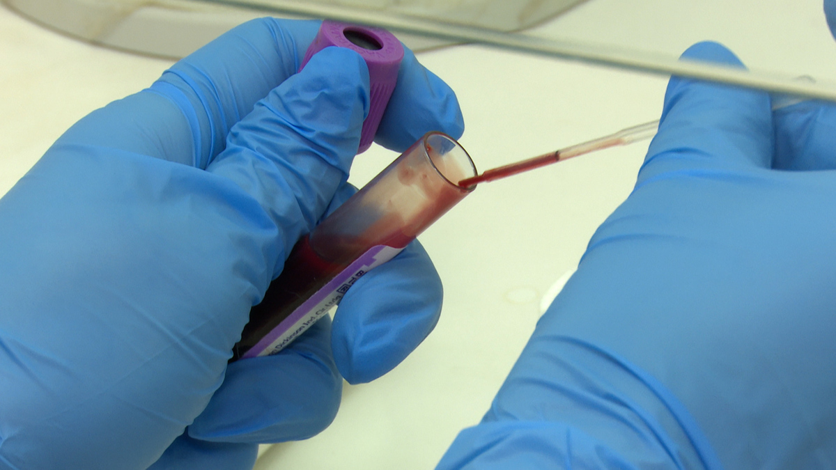 Hepatites virais: conheça formas de transmissão e saiba como se prevenir da doença